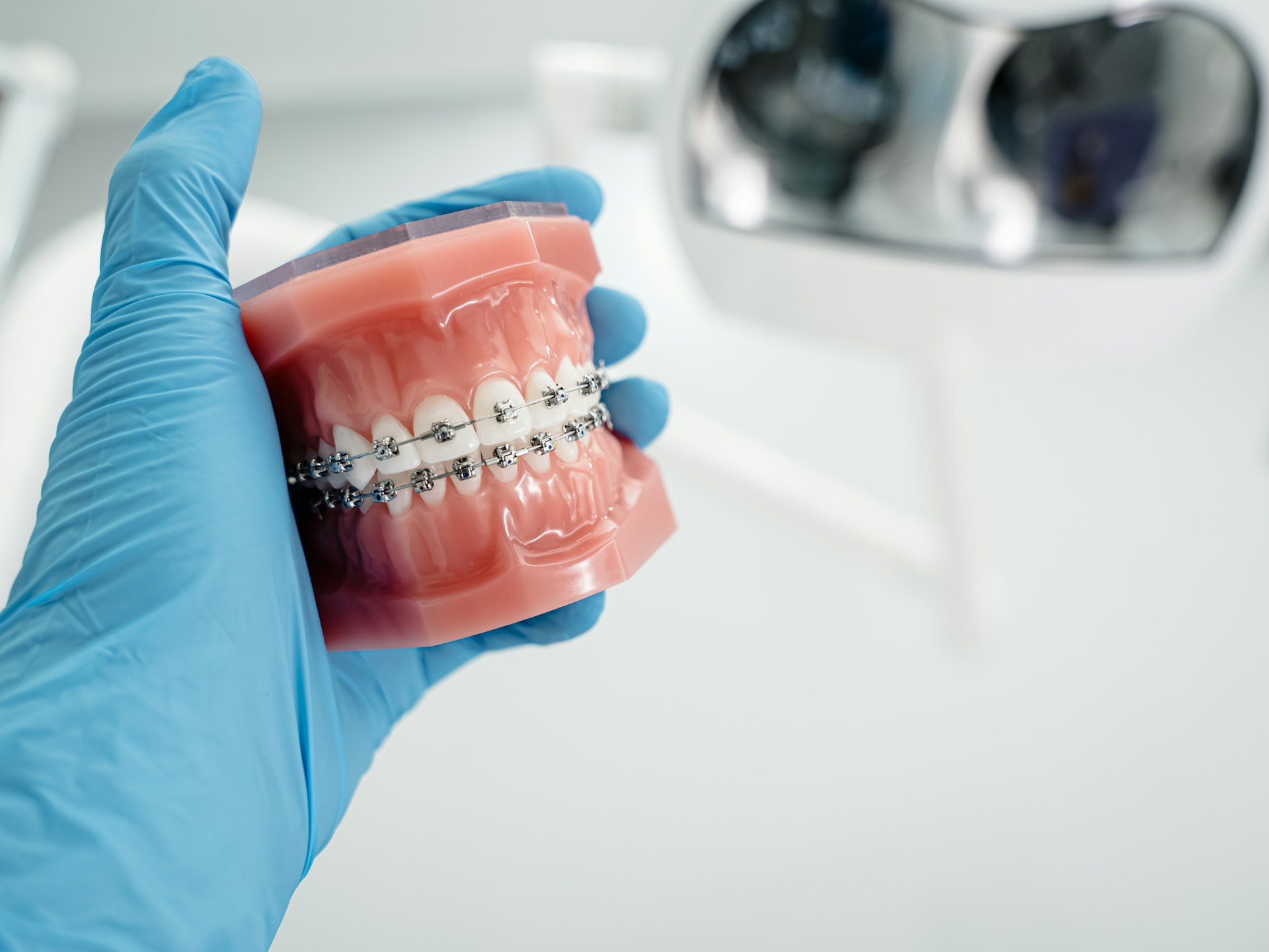 L’essentiel à connaître sur l’orthodontie